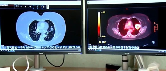 ����˹��ǰ��1�µ�ɨ�裨��өĻ����4���º��ɨ�裨��өĻ������Ԩ֮��