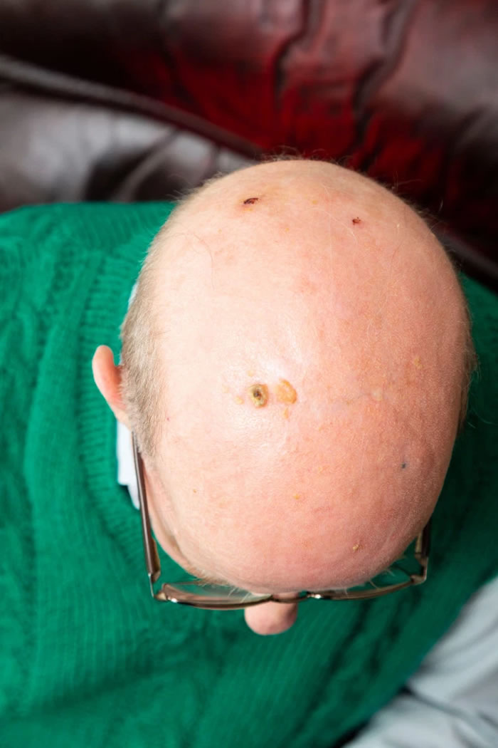 Ӣ�������Ŀ��Ϸ��޳��žͱ��ڼ�Ÿ�ĵ���ͷѪ �ұ�