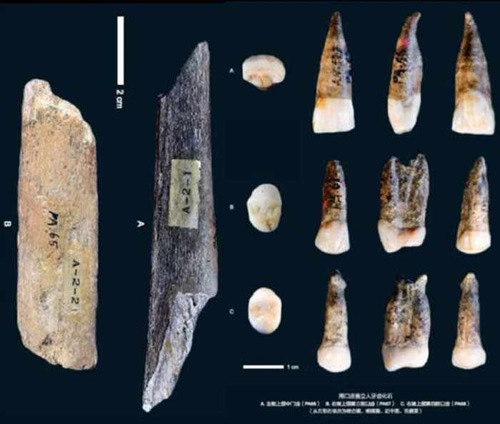 ����Գ��ͷ�ǹǷ���90���� ����Ȩ��������ǵ�����