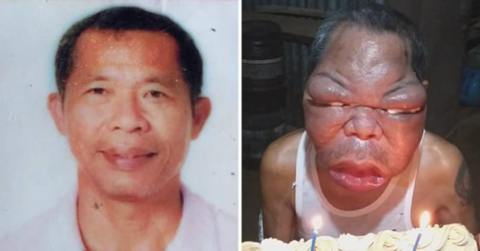 ���ɱ����ص����ӵ��˲������� ���׳���ǰ������