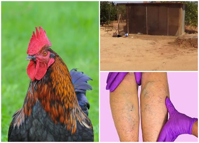 澳洲患静脉曲张老妇被公鸡啄了一口因失血过多死亡
