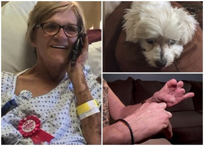 ��������ιʳ������˹Ȯʱ������ҧ�˸�ȾȮҧ������̼����ά�� ��˫�ż�6ָֻ����