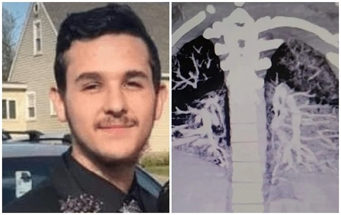 ������Ϧ������19�����ӳ�2������� ��Ƭ���Ѿ����Ӳ���ķ������