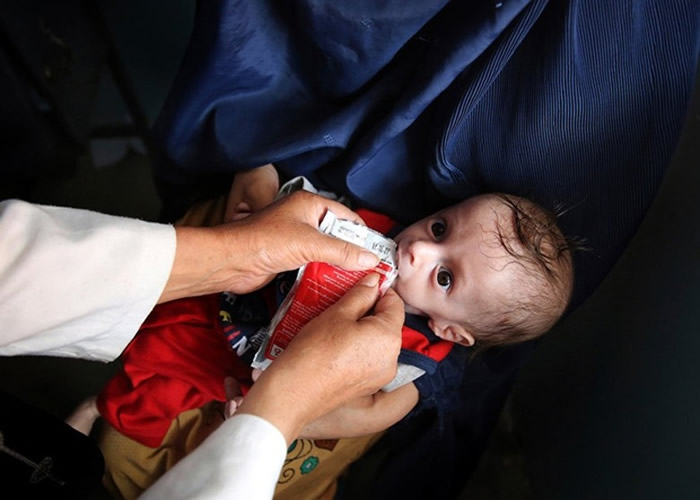 ��ǧ������ͯ��������֢��