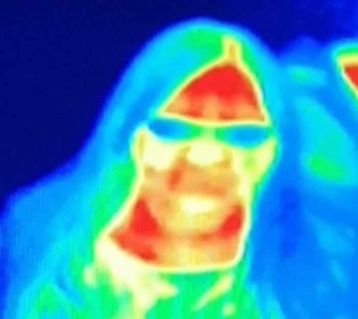 英国女子参观博物馆进入红外线显像仪时发现左胸出现红色斑点 就医检测出早期乳癌