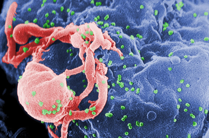 世界首例！中国科学家实现以基因编辑细胞抵御艾滋病毒