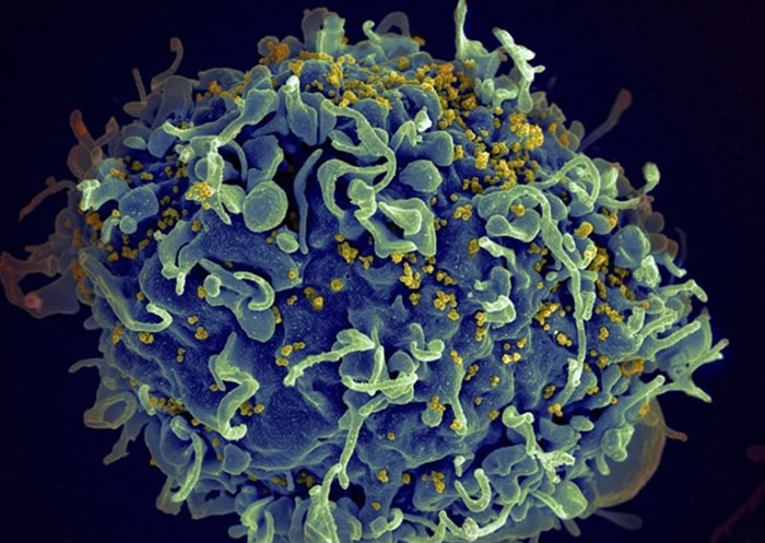 HIV（黄点）病毒具有随时变化及变异的能力。