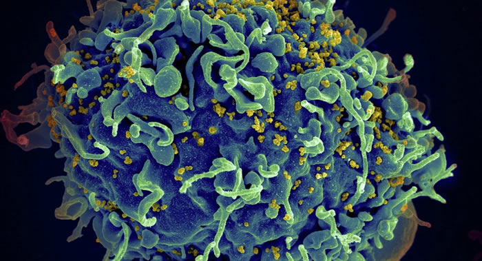 全球首个艾滋病病毒阳性人群精子库在新西兰启动 取名为“阳性精子”