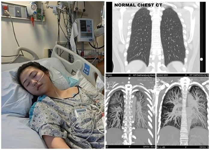 �޿������ٲ��� ��������������ʳ�����̵����Ừ��Ů����Σ