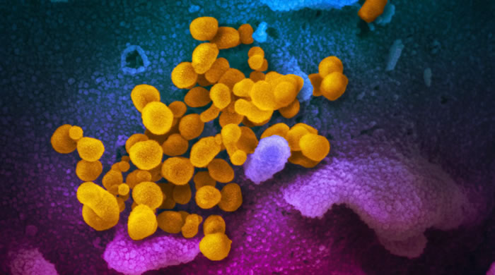 美国国家过敏和传染病研究所（NIAID）发布新型冠状病毒COVID-19最新彩色显微镜图像