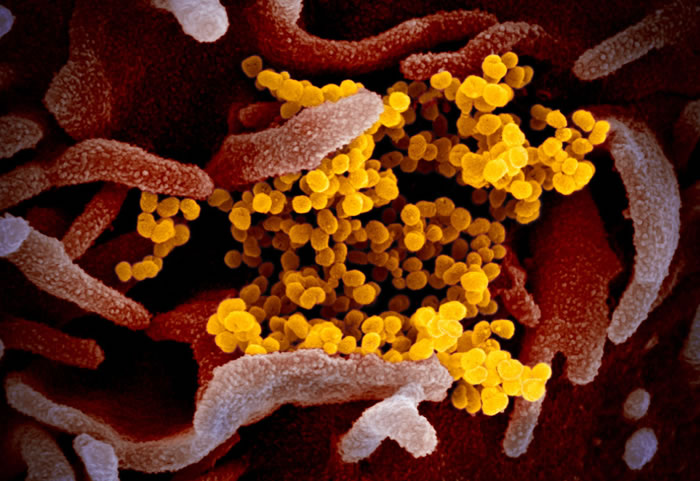 美国国家过敏和传染病研究所（NIAID）发布新型冠状病毒COVID-19最新彩色显微镜图像
