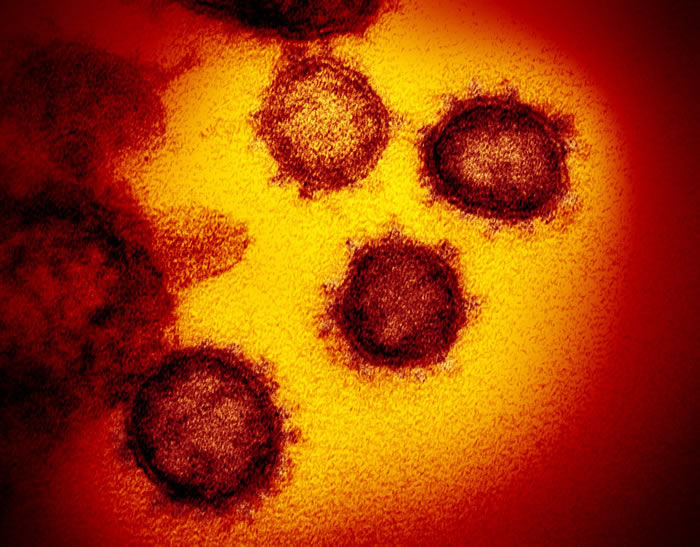 美国过敏与感染疾病中心（NIAID）发布新冠病毒影像 与一般冠状病毒相似
