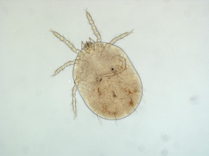 恙虫（标本照，幼虫为六只脚）。 图片提供：国立台湾师范大学