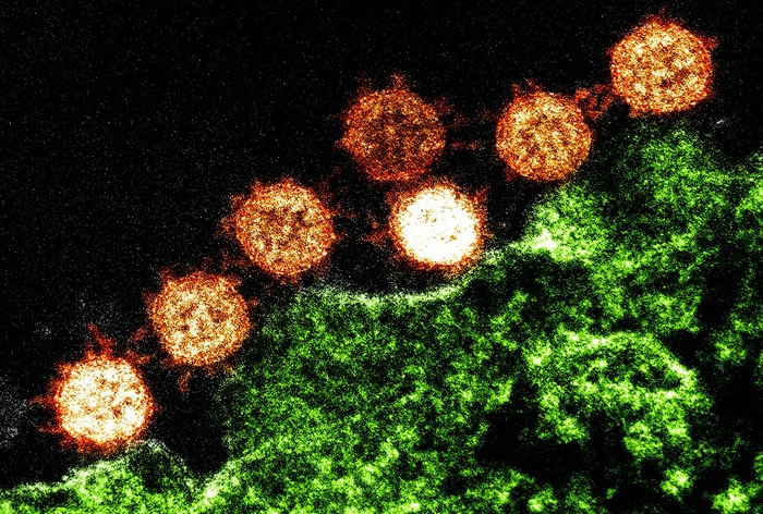 澳洲及巴西研究人员指新冠病毒的基因已出现变种