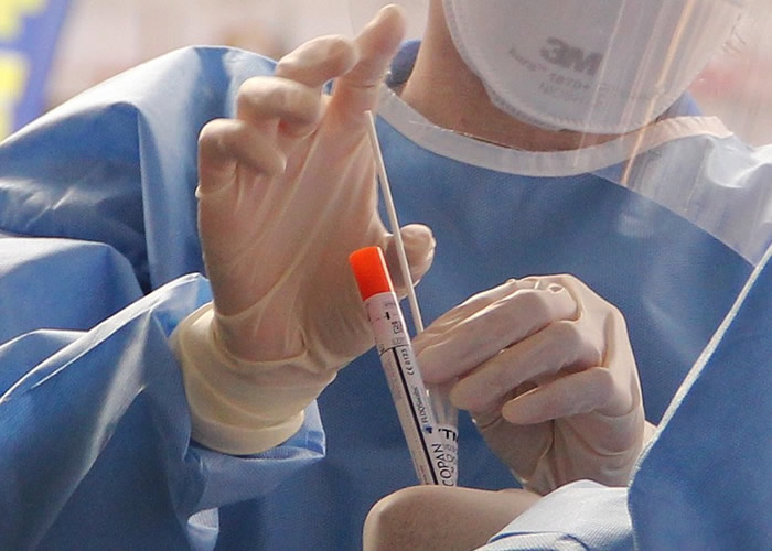 ����ʳƷ��ҩ���������׼������Ϲ�˾Cepheid�з����¹ڷ��ײ������ٲ��Է���