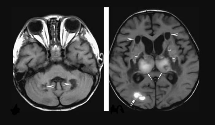 �¹ڷ��׻����ֺ�������֢�����Ի������Բ��䡱 ��������з�