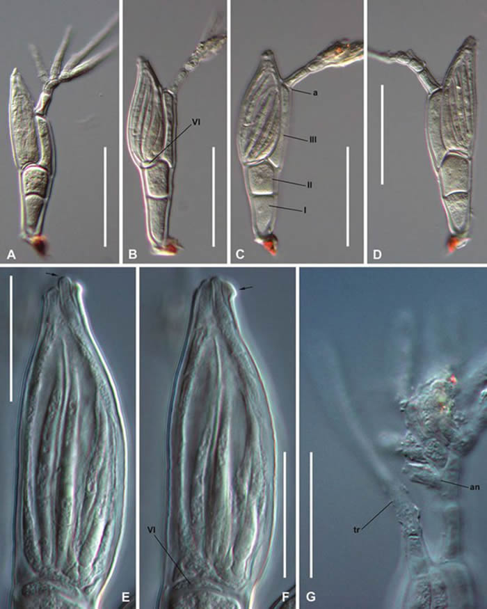 ͨطͼ ΪTroglomyces twitteri