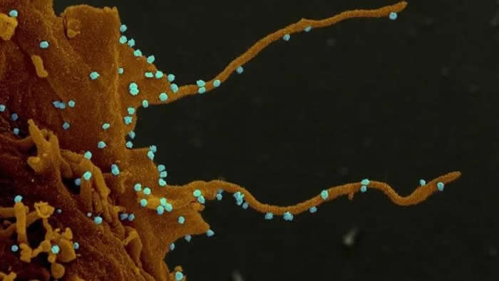 美国加州大学研究人员显微镜下拍摄到新冠病毒图像 丝状触手侵略人体健康细胞令人震撼