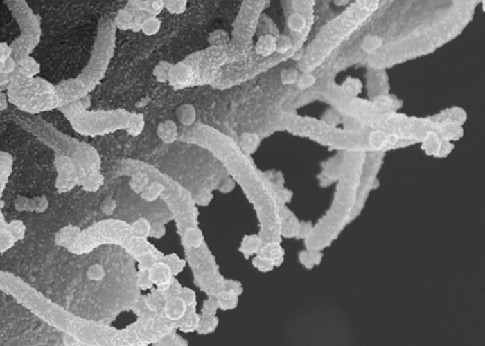 �����о������¹ڲ��������ܸ�Ⱦ������ϸ������ʬ���� ���������롱