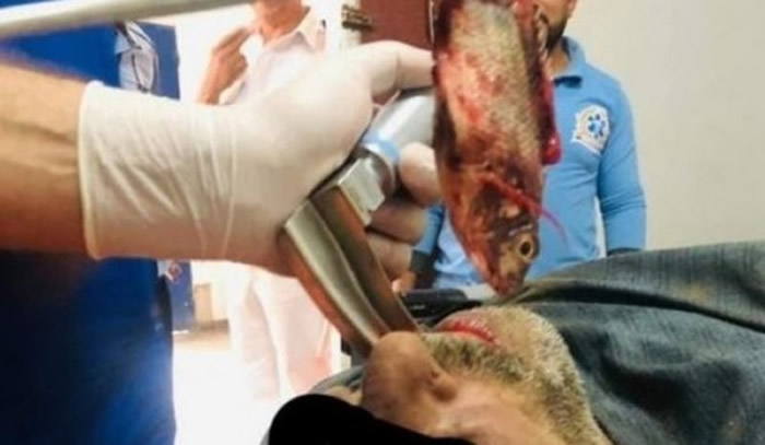 埃及渔夫在溪中把捕到的鱼放进嘴里含着 谁知鱼滑向喉咙深处