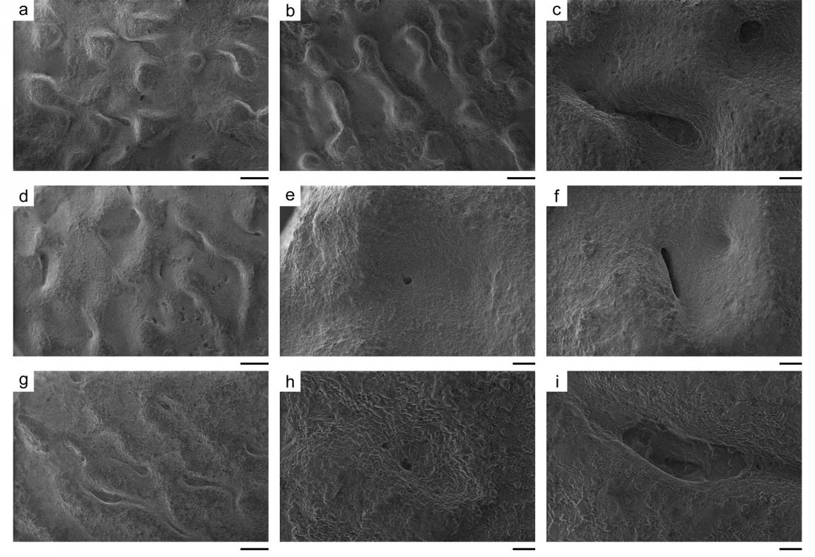 坪岭叠层蛋蛋壳纹饰及气孔开口特征,上、中、下分别为南雄、山阳、莱阳的材料(a,b,d,g标尺为500 μm,c,e,f,h,i标尺为100 μm)
