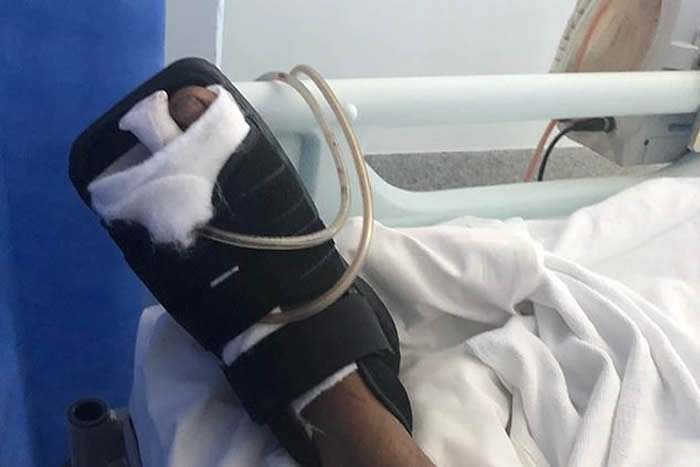 ����������5���߳��ľ�������ľͷ һ�Ų���ȥ��ҧ��2����ֺ