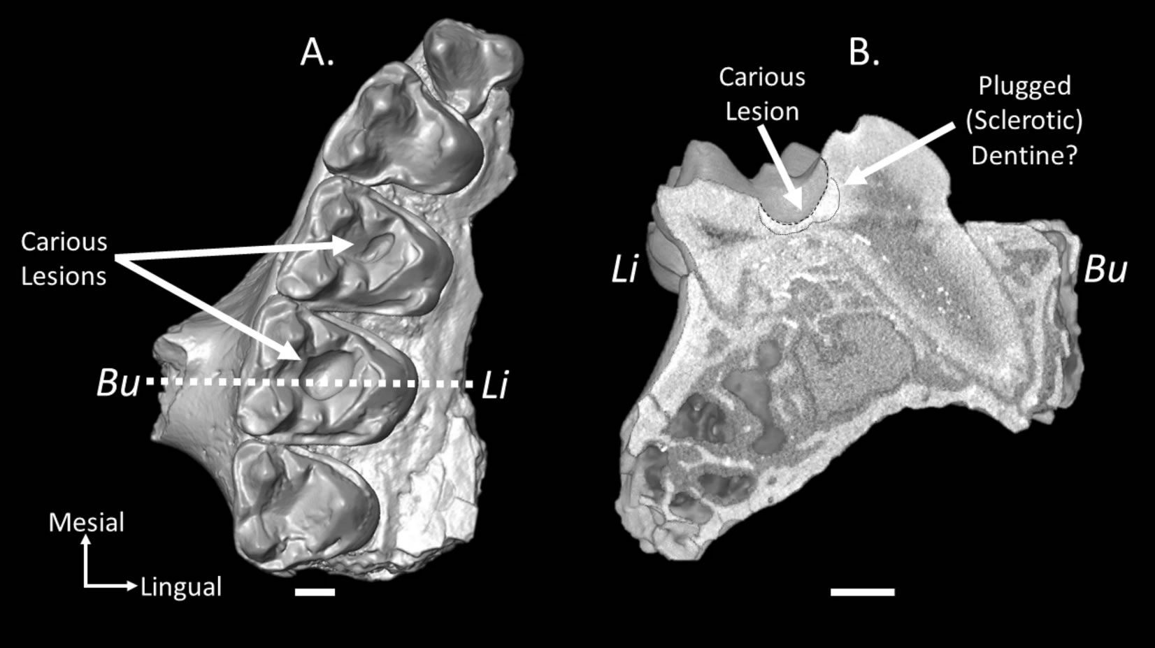 龋齿化石表明史前灵长类动物可能爱吃甜食