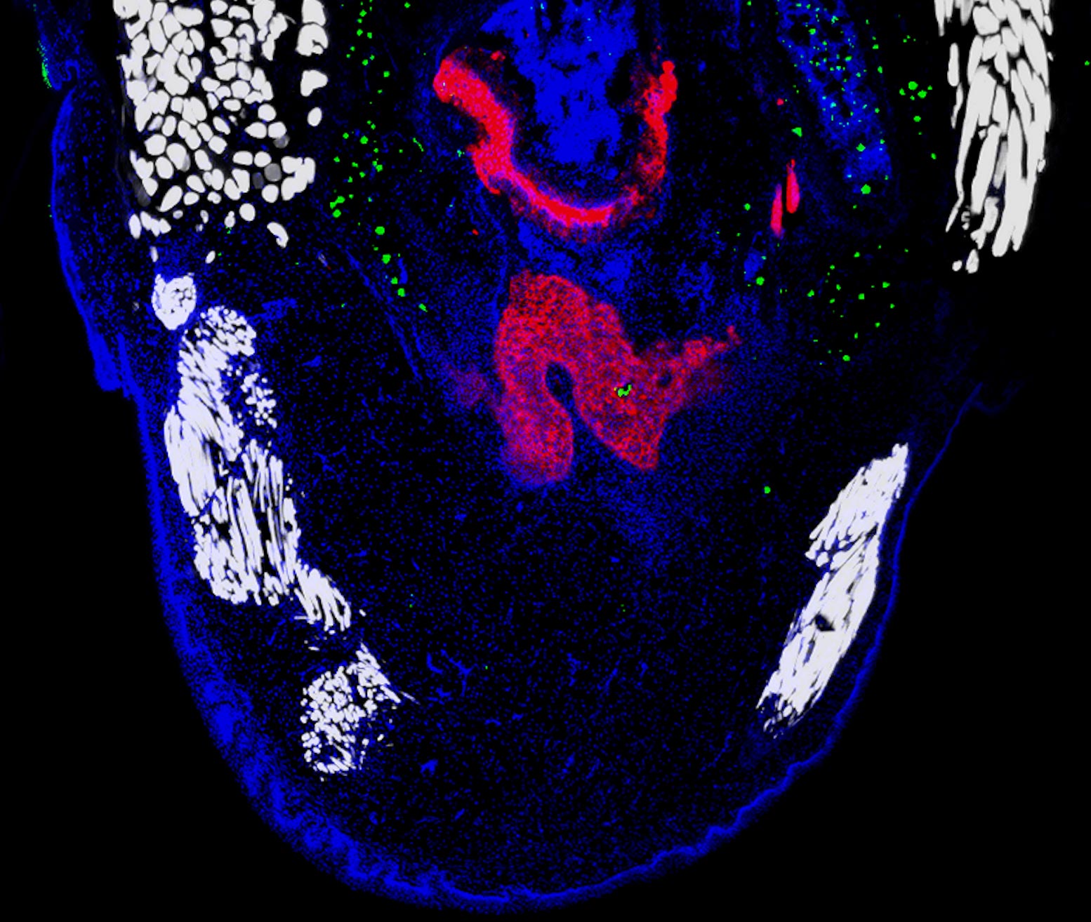 哀伤壁虎囊肿的组织学。肌肉为白色，软骨为红色，增殖细胞为绿色，细胞核为蓝色。资料来源：南加州大学/洛兹托实验室