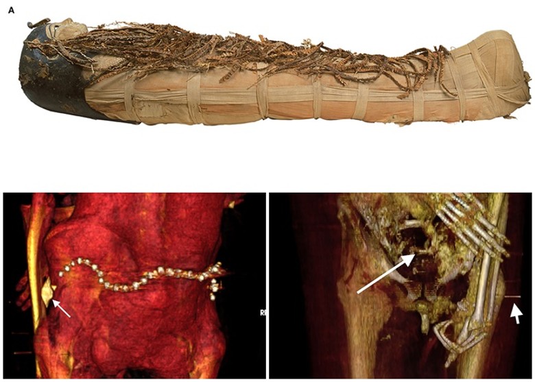 阿孟霍特普一世在下葬时戴有腰带（左下图），手指碎裂相信是盗墓者所为。