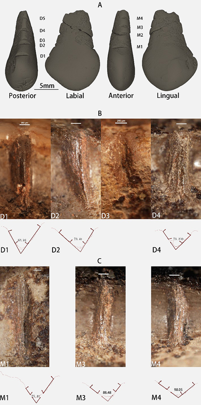 (A) ݸ̻Ƶλ; (B) ݸ̻Ƶ̬Ƕ(); (C) ݸǰ̻Ƶ̬Ƕ(). : (A) 5 mm,