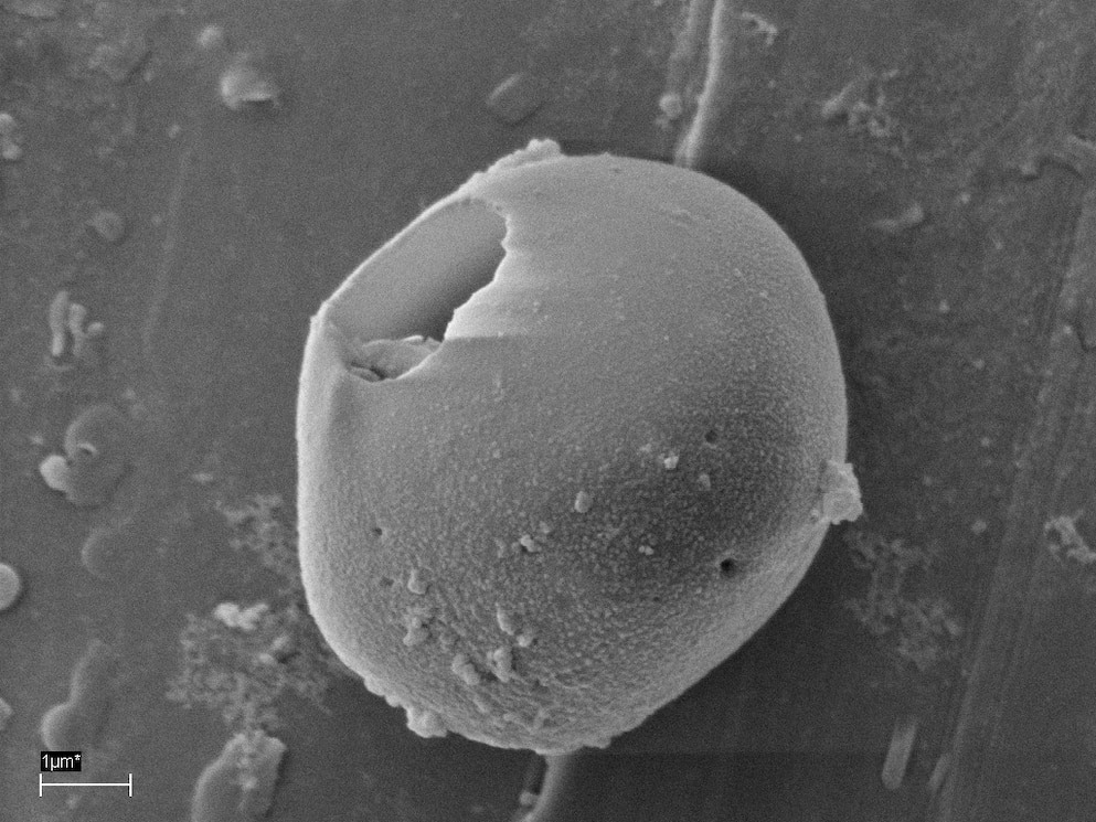 这项分析找到了像微型藻类（上）和寄生虫卵（下）之类的微小海洋物体。　PHOTOGRAPH BY PROFESSOR ALVARO ANDRADE