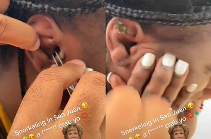 波多黎各女游客在圣胡安浮潜时觉得耳朵跑进异物 请医生帮忙时竟然窜出一只活的小螃蟹