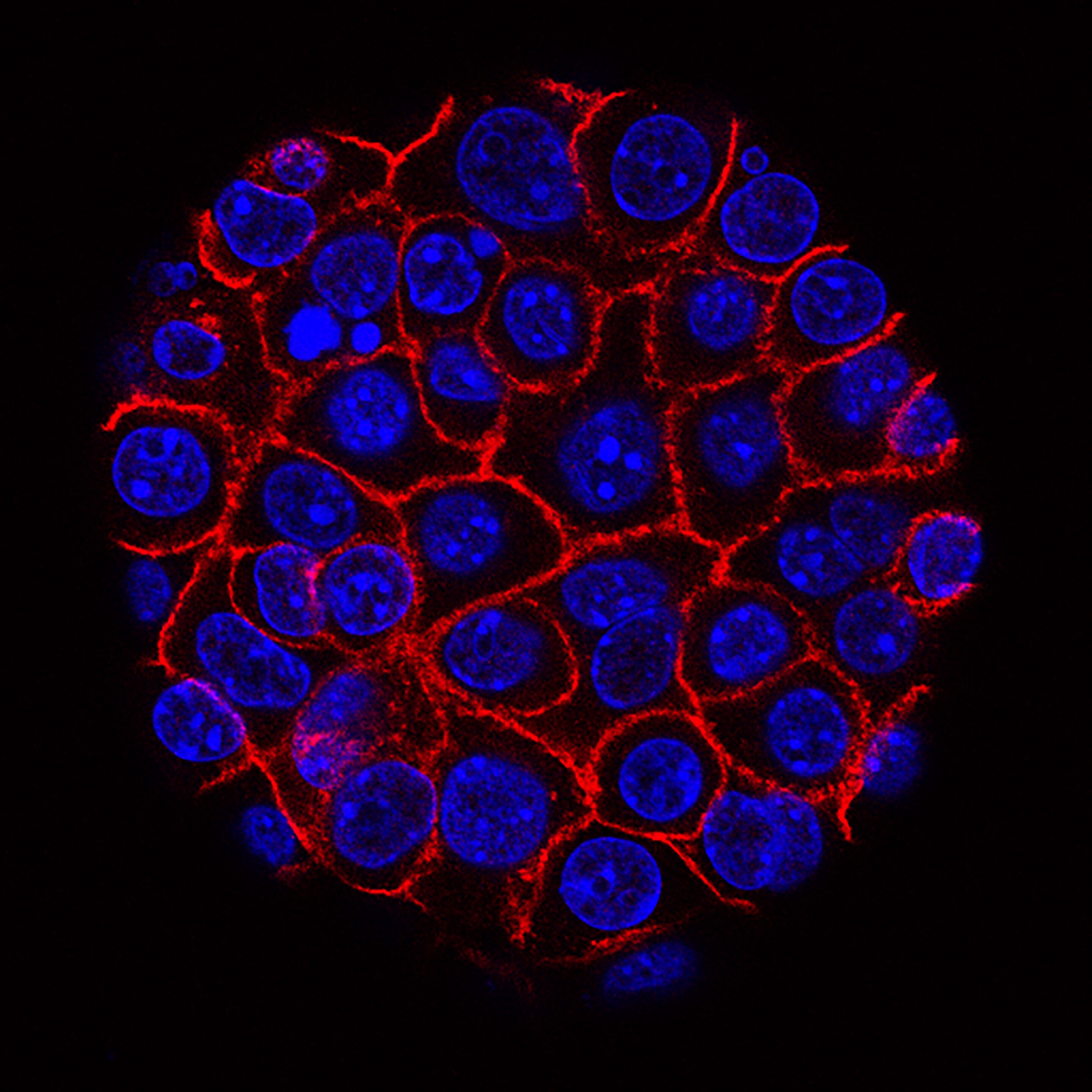 胰腺癌如何利用蛋白质来对抗治疗