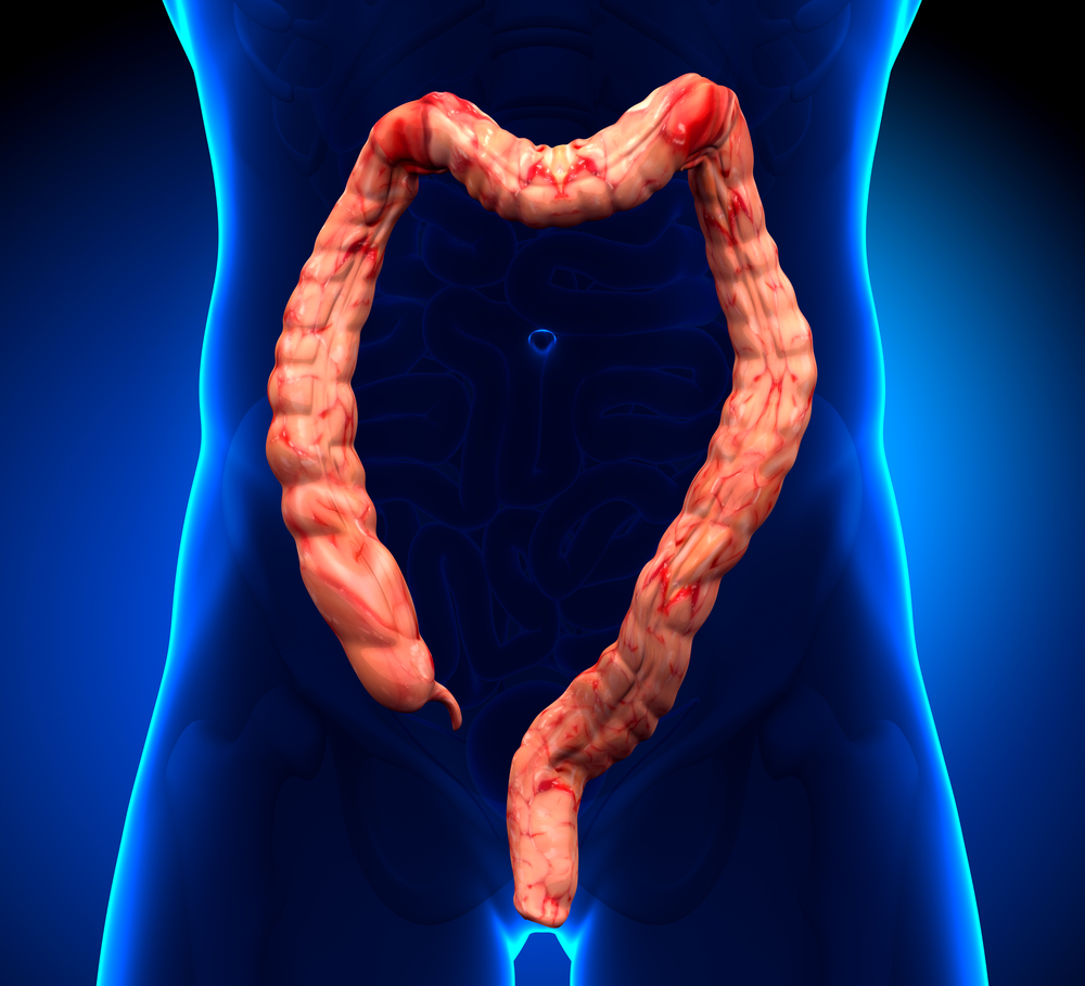 《胃肠病学》：人工智能用于预测溃疡性结肠炎活动的未来爆发