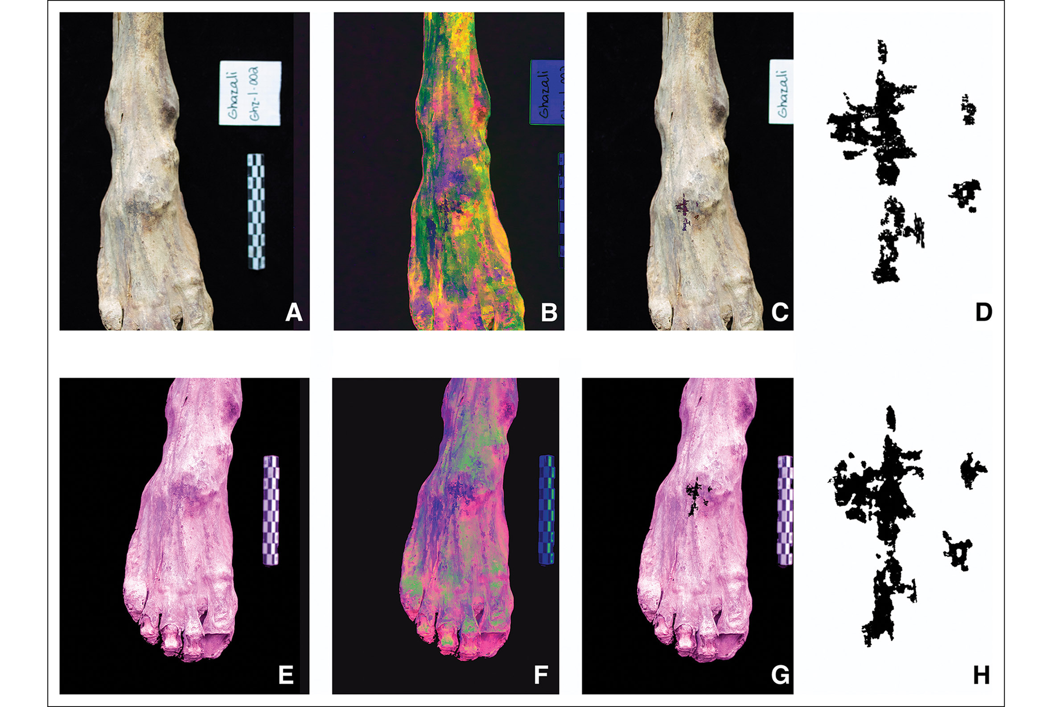 考古研究记录了中世纪努比亚人罕见的基督教纹身