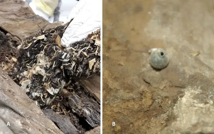 奥地利牧师木乃伊直肠在保存中起着重要作用