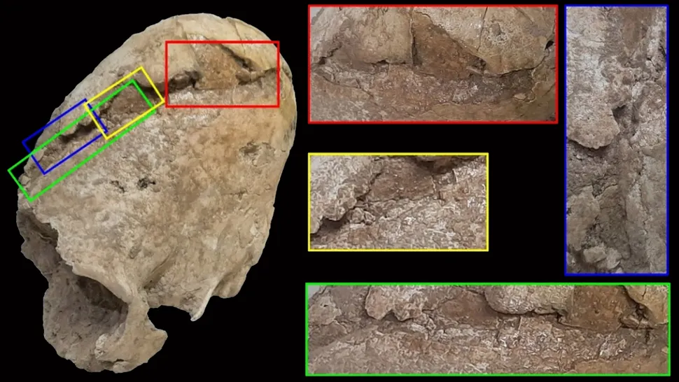 6200年前伊朗的“锥形”头骨遭到撞击,但没有人知道原因