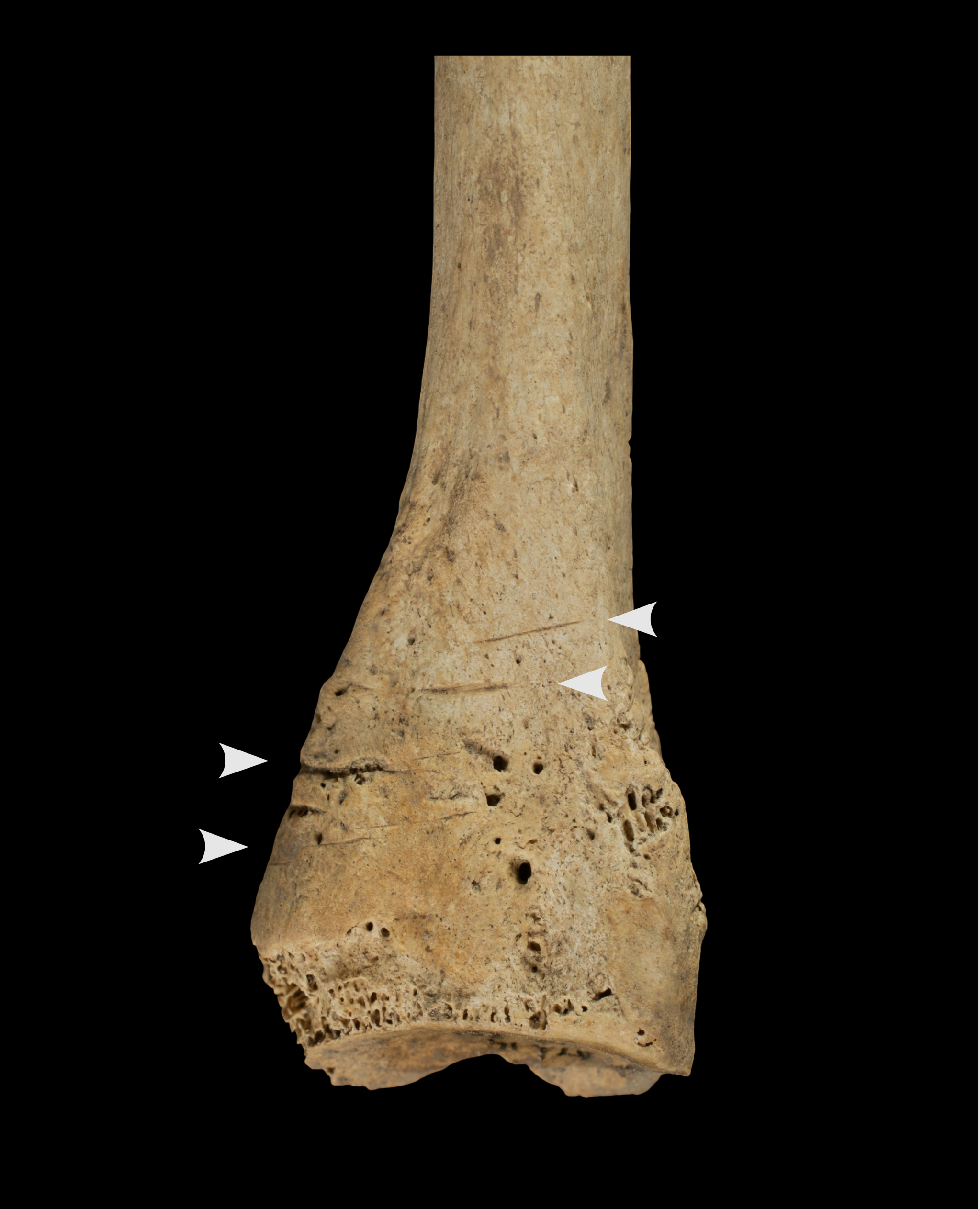 ������ʷǰ��Ѩ�����ġ�սʱͬ����ʳ��