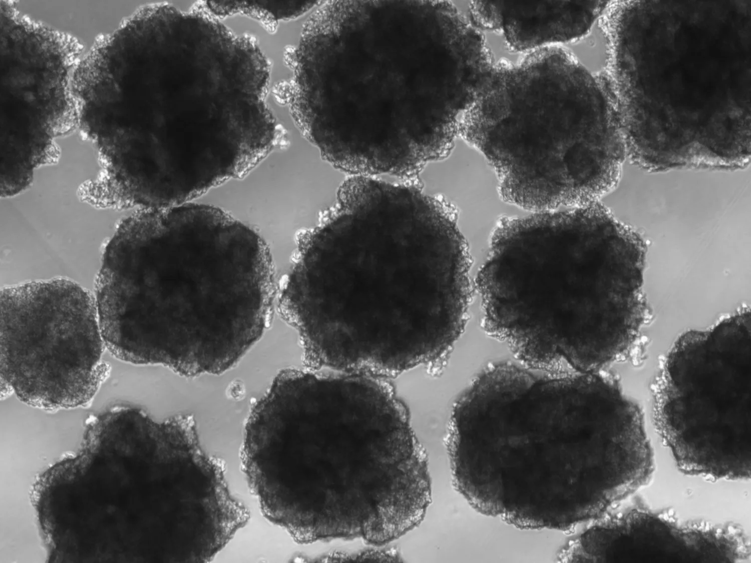 铅毒害人类已有200多万年的历史