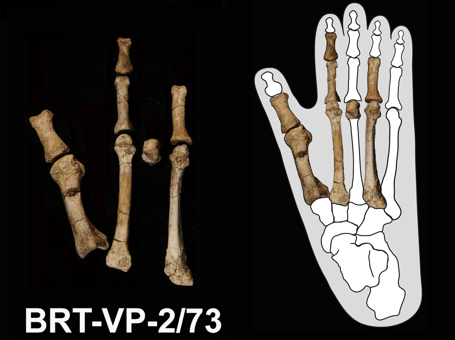 Australopithecus deyiremeda¶ڹƽ