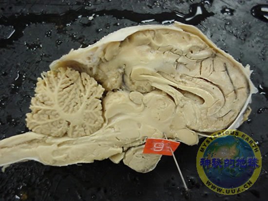 下视丘(hypothalamus)图片