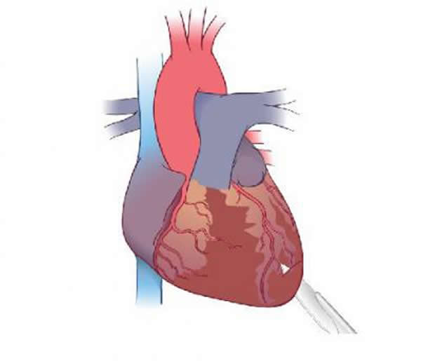 与成年老鼠心脏以疤痕形成来愈合的方式相反,新生的心脏损伤后三个