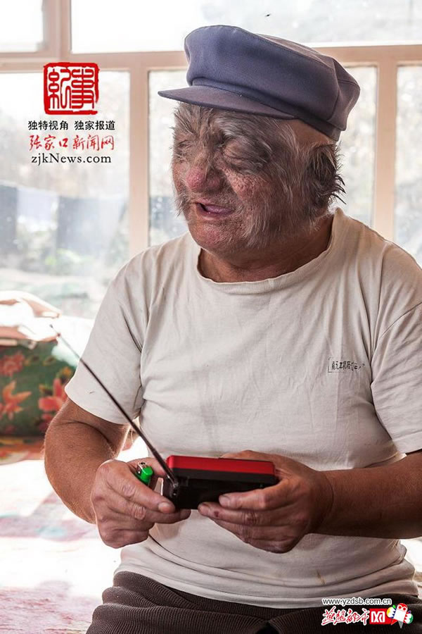 河北崇礼毛人张兴近况