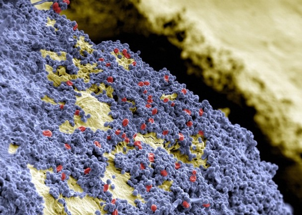 细菌会密密麻麻的铺满在牙齿表面,十分恐怖.