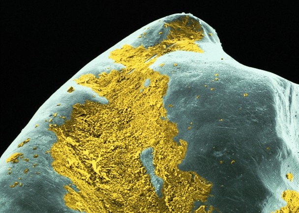 吓人:未有刷干净的牙齿表面电子显微镜图片