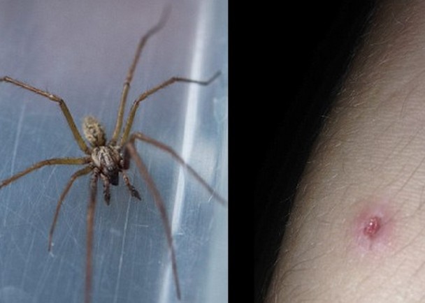 英国巨型毒蜘蛛流浪汉蜘蛛袭击居民