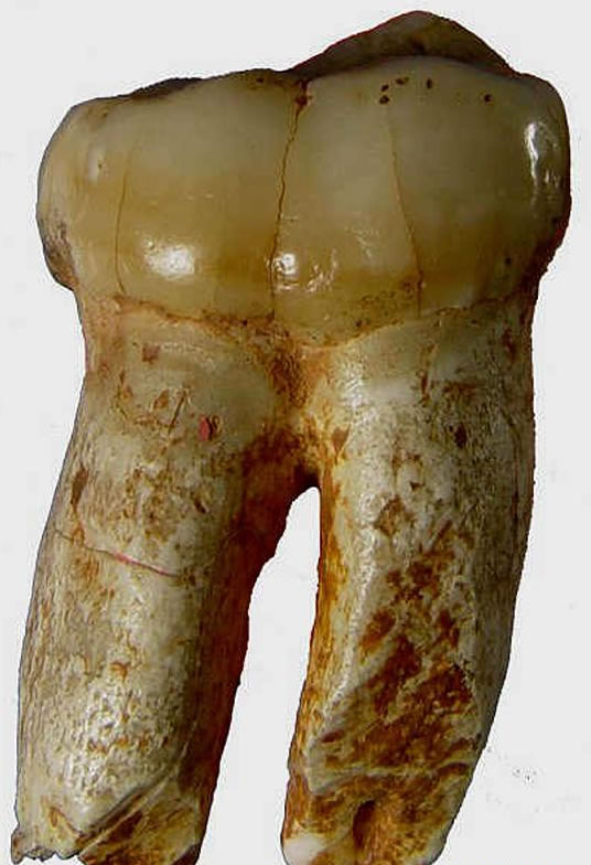 么会洞发现的巨猿牙齿化石