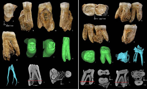 和县人牙齿釉质,齿质,髓腔形态特征(邢松供图)