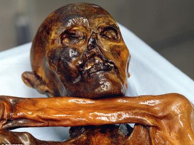 5300年前冰人奥茨木乃伊上发现人类最古老血细胞