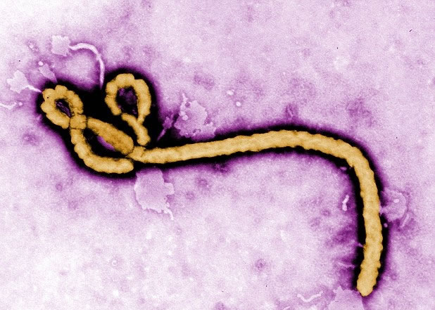 伊波拉病毒或早于2400年前已在古希腊雅典肆虐长达5年